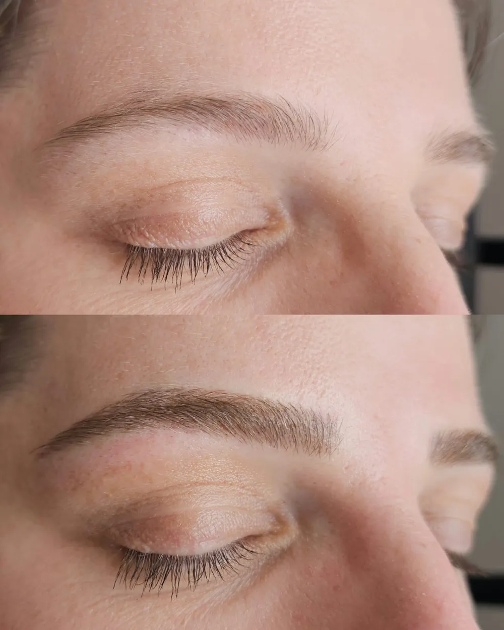 Antes e depois de micropigmentação de sobrancelhas, caso 02, atendido por Livia First