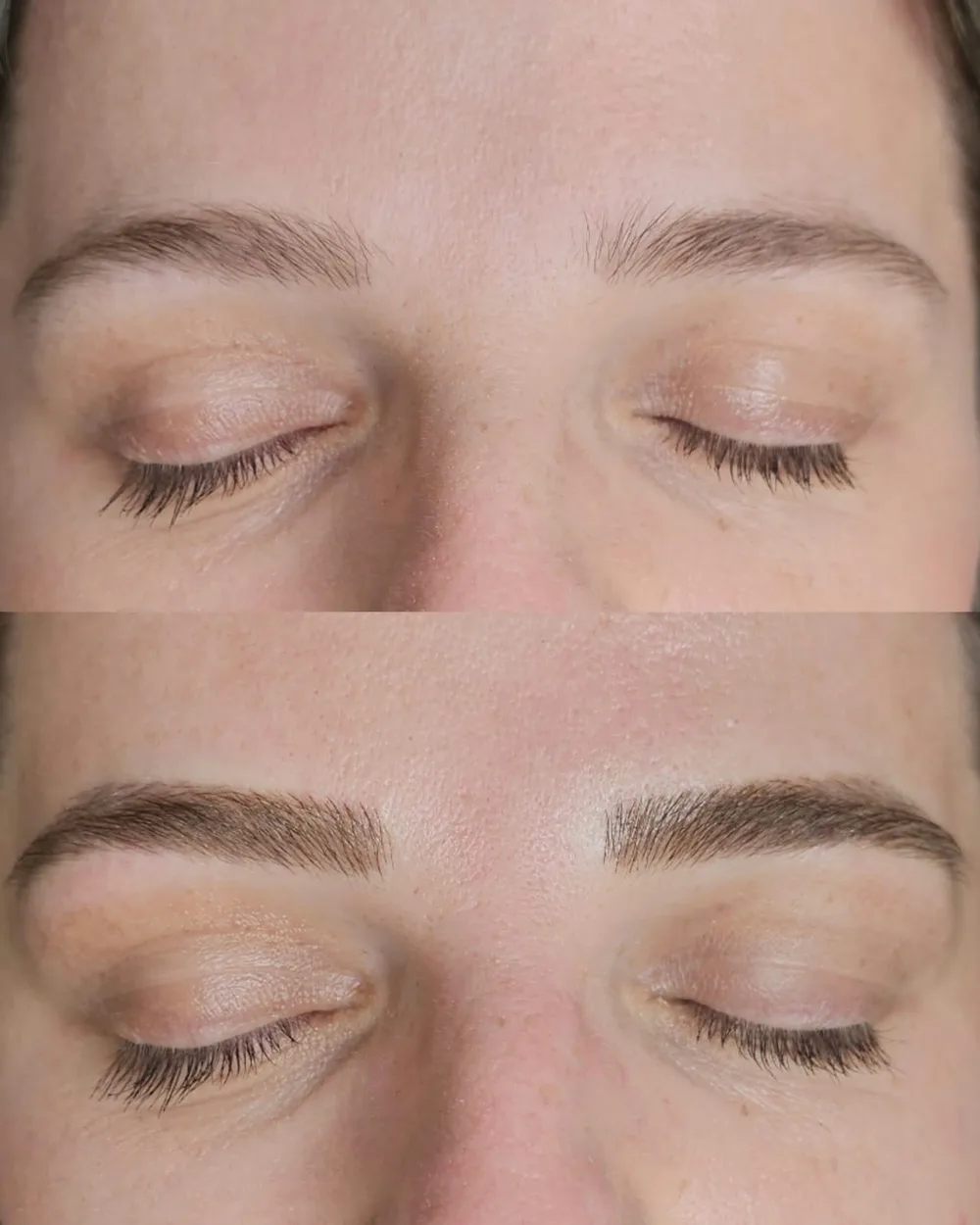 Antes e depois de micropigmentação de sobrancelhas, caso 04, atendido por Livia First